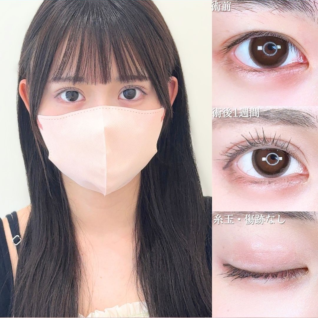 No.16559の症例写真